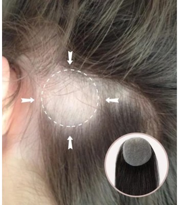 Full Skin Base Cover-Up Hair Patches Pieces Keine Chirurgische Lösung Für Alopecia Areata Full Skin Base Cover-Up Hair Patches Pieces Keine Chirurgische Lösung Für Alopecia Areata