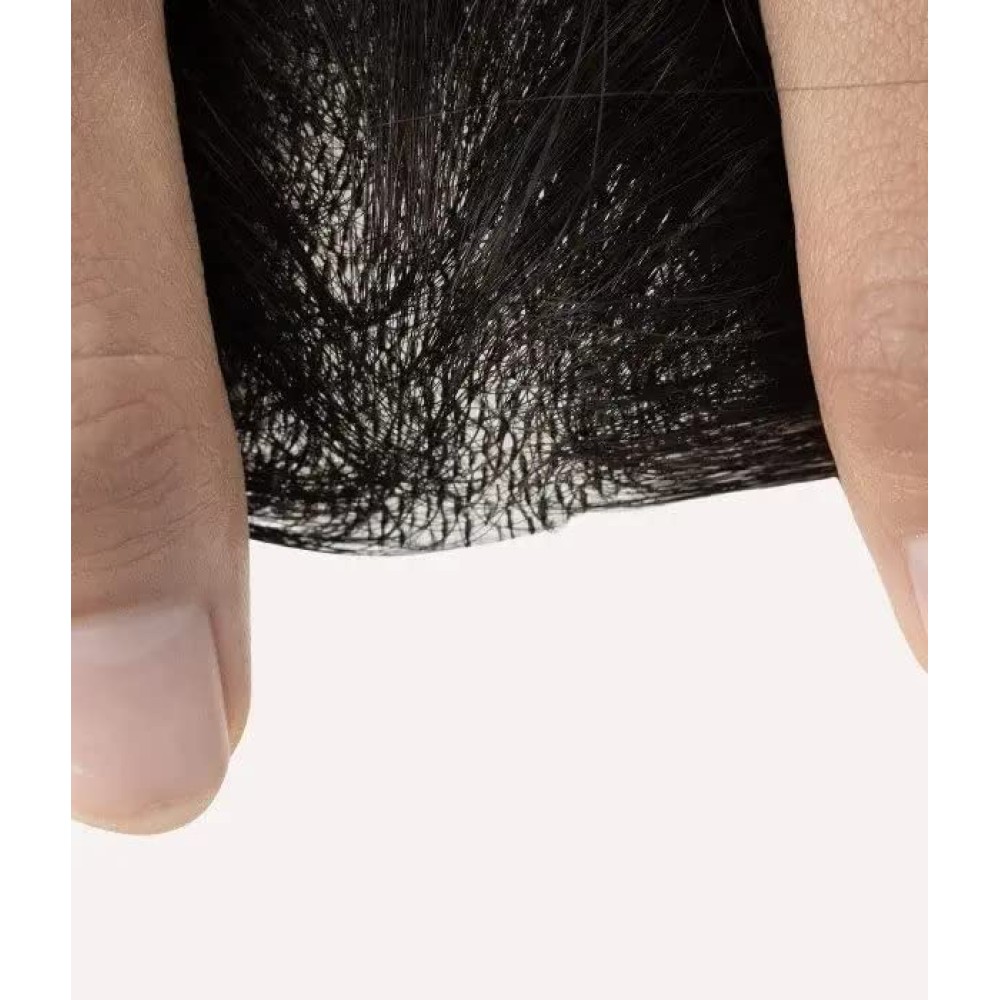 Full Skin Base CoverUp Hair Patches Pieces Keine Chirurgische Lösung