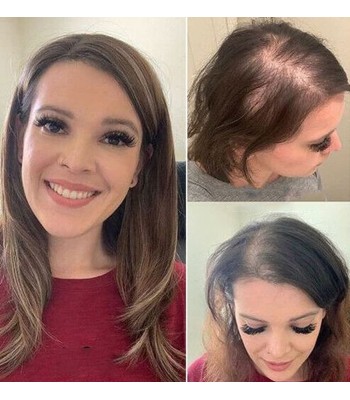 Verbesserte Top-Haarteile Aus Echtem Menschenhaar Für Dünner Werdendes Haar Verbesserte Top-Haarteile Aus Echtem Menschenhaar Für Dünner Werdendes Haar